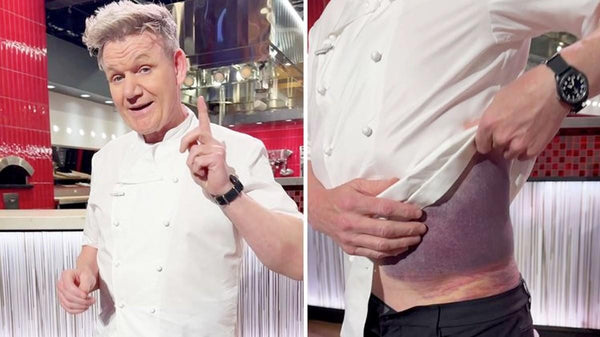 Gordon Ramsay cade in bici: "Indossate il casco, mi ha salvato la vita". Brutta caduta in bicicletta per il celebre Chef